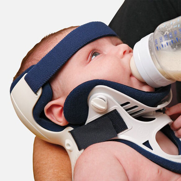Imobilizador pediátrico PAPOOSE NECLOC® imobilização para recém nascidos, com colar cervical. Imobilização segura, estável, permite exame e vacinação.