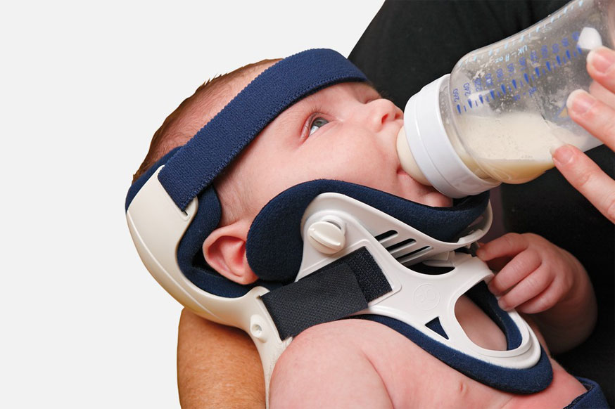 Imobilizador pediátrico PAPOOSE NECLOC® imobilização para recém nascidos, com colar cervical. Imobilização segura, estável, permite exame e vacinação.